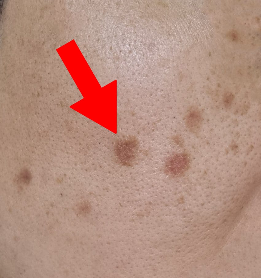 갈색 어두운 자국