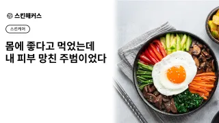 여드름에 좋은 음식 vs 피해야 할 음식